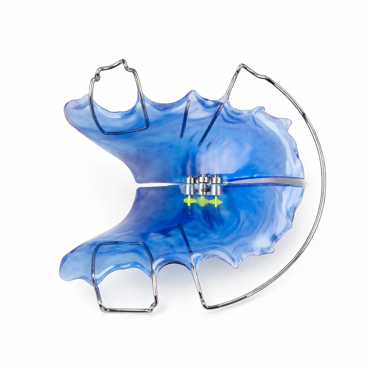 Gaumenerweiterungsapparaturen